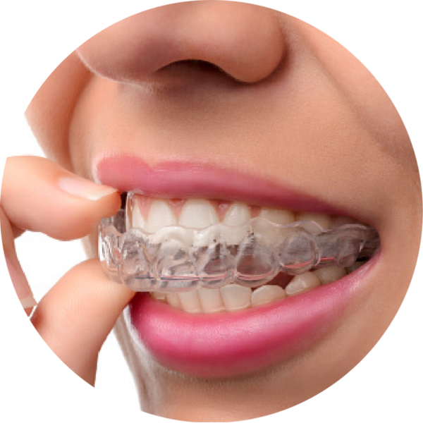 OTTODONZIA INVISIBILE