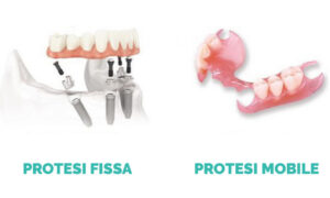 PROTESI FISSA E MOBILE